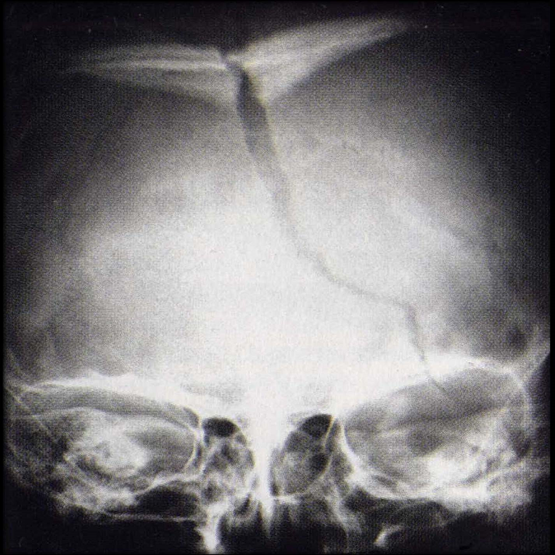 Skull Graphic Fragment
